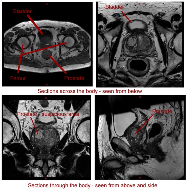 MRI Scans labels